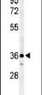 C-C chemokine receptor type 1 antibody, PA5-24785, Invitrogen Antibodies, Western Blot image 