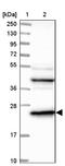 Thymidylate kinase antibody, NBP1-91850, Novus Biologicals, Western Blot image 