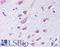 Semaphorin 3B antibody, LS-C140949, Lifespan Biosciences, Immunohistochemistry paraffin image 