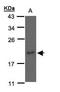Nucleoside diphosphate kinase C antibody, GTX108324, GeneTex, Western Blot image 