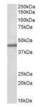 Inositol Hexakisphosphate Kinase 3 antibody, orb318737, Biorbyt, Western Blot image 