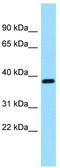 Reticulocalbin 3 antibody, TA331220, Origene, Western Blot image 