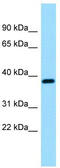 Reticulocalbin 3 antibody, TA331220, Origene, Western Blot image 