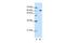 Glucocorticoid Modulatory Element Binding Protein 2 antibody, GTX49002, GeneTex, Western Blot image 