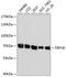 Transient receptor potential cation channel subfamily V member 6 antibody, 15-801, ProSci, Western Blot image 