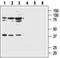 Melanocortin 1 Receptor antibody, TA328624, Origene, Western Blot image 