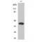 Insulin gene enhancer protein ISL-2 antibody, LS-C384192, Lifespan Biosciences, Western Blot image 