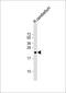 CD81 Molecule antibody, M01281, Boster Biological Technology, Western Blot image 