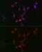 Transgelin 2 antibody, GTX33556, GeneTex, Immunofluorescence image 