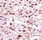 Casein Kinase 2 Alpha 1 antibody, LS-C101283, Lifespan Biosciences, Immunohistochemistry frozen image 