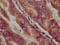 Phosphopantothenoylcysteine Decarboxylase antibody, LS-C681106, Lifespan Biosciences, Immunohistochemistry paraffin image 