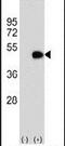 ILK Associated Serine/Threonine Phosphatase antibody, PA5-25778, Invitrogen Antibodies, Western Blot image 