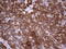 TIMELESS-interacting protein antibody, LS-C338619, Lifespan Biosciences, Immunohistochemistry paraffin image 