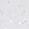 Spermatogenesis Associated 18 antibody, PA5-57848, Invitrogen Antibodies, Immunohistochemistry frozen image 