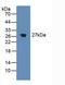 Stromal Cell Derived Factor 4 antibody, LS-C296516, Lifespan Biosciences, Western Blot image 