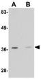 Regulator Of G Protein Signaling 21 antibody, GTX85280, GeneTex, Western Blot image 