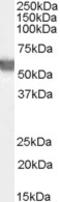 Transglutaminase 2 antibody, 46-485, ProSci, Western Blot image 