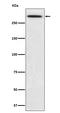 Spectrin Alpha, Erythrocytic 1 antibody, M03376, Boster Biological Technology, Western Blot image 