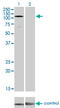 EPH Receptor A3 antibody, LS-C197142, Lifespan Biosciences, Western Blot image 