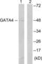 GATA Binding Protein 4 antibody, LS-C117901, Lifespan Biosciences, Western Blot image 