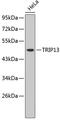 Thyroid Hormone Receptor Interactor 13 antibody, 19-044, ProSci, Western Blot image 
