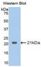 Glucosidase Alpha, Acid antibody, MBS2001941, MyBioSource, Western Blot image 