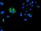 Calcium Modulating Ligand antibody, MA5-25883, Invitrogen Antibodies, Immunocytochemistry image 