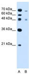 Zinc Finger FYVE-Type Containing 27 antibody, TA335291, Origene, Western Blot image 