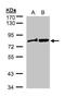 Dishevelled Segment Polarity Protein 2 antibody, GTX103878, GeneTex, Western Blot image 