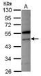 Vacuolar Protein Sorting 4 Homolog A antibody, NBP2-20879, Novus Biologicals, Western Blot image 