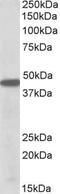 PBX Homeobox 1 antibody, PA5-19312, Invitrogen Antibodies, Western Blot image 