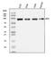 B-Raf Proto-Oncogene, Serine/Threonine Kinase antibody, PB9164, Boster Biological Technology, Western Blot image 