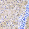 Glutathione Peroxidase 4 antibody, LS-C331776, Lifespan Biosciences, Immunohistochemistry paraffin image 