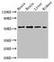 Protein Phosphatase 2 Regulatory Subunit Balpha antibody, CSB-PA018564LA01HU, Cusabio, Western Blot image 