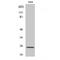 Adenylate Kinase 5 antibody, LS-C381947, Lifespan Biosciences, Western Blot image 