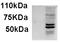 Absent In Melanoma 2 antibody, AP22454PU-N, Origene, Western Blot image 