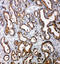 Toll Interacting Protein antibody, LS-C313134, Lifespan Biosciences, Immunohistochemistry paraffin image 