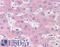 Solute Carrier Family 3 Member 2 antibody, LS-B2271, Lifespan Biosciences, Immunohistochemistry paraffin image 