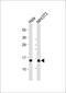 Ring-Box 1 antibody, M00524-1, Boster Biological Technology, Western Blot image 