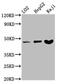 Serpin Family B Member 2 antibody, CSB-PA021070LA01HU, Cusabio, Western Blot image 