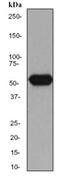 Aldehyde Dehydrogenase 1 Family Member A1 antibody, ab52492, Abcam, Western Blot image 