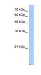 NAD(P) Dependent Steroid Dehydrogenase-Like antibody, NBP1-59799, Novus Biologicals, Western Blot image 