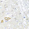 Methylcrotonoyl-CoA Carboxylase 2 antibody, A06515, Boster Biological Technology, Immunohistochemistry frozen image 