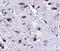 Regulator Of Calcineurin 2 antibody, A11369, Boster Biological Technology, Immunohistochemistry frozen image 