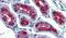 Thyroid Stimulating Hormone Receptor antibody, PA5-34296, Invitrogen Antibodies, Immunohistochemistry paraffin image 