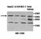 Zinc Finger Protein 101 antibody, orb77959, Biorbyt, Western Blot image 