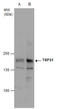 Transcriptional Repressor GATA Binding 1 antibody, GTX129429, GeneTex, Western Blot image 