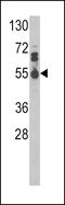 Interleukin 17 Receptor B antibody, LS-C165179, Lifespan Biosciences, Western Blot image 