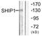 Inositol Polyphosphate-5-Phosphatase D antibody, LS-C117781, Lifespan Biosciences, Western Blot image 