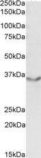 DNA Ligase 1 antibody, 42-770, ProSci, Western Blot image 